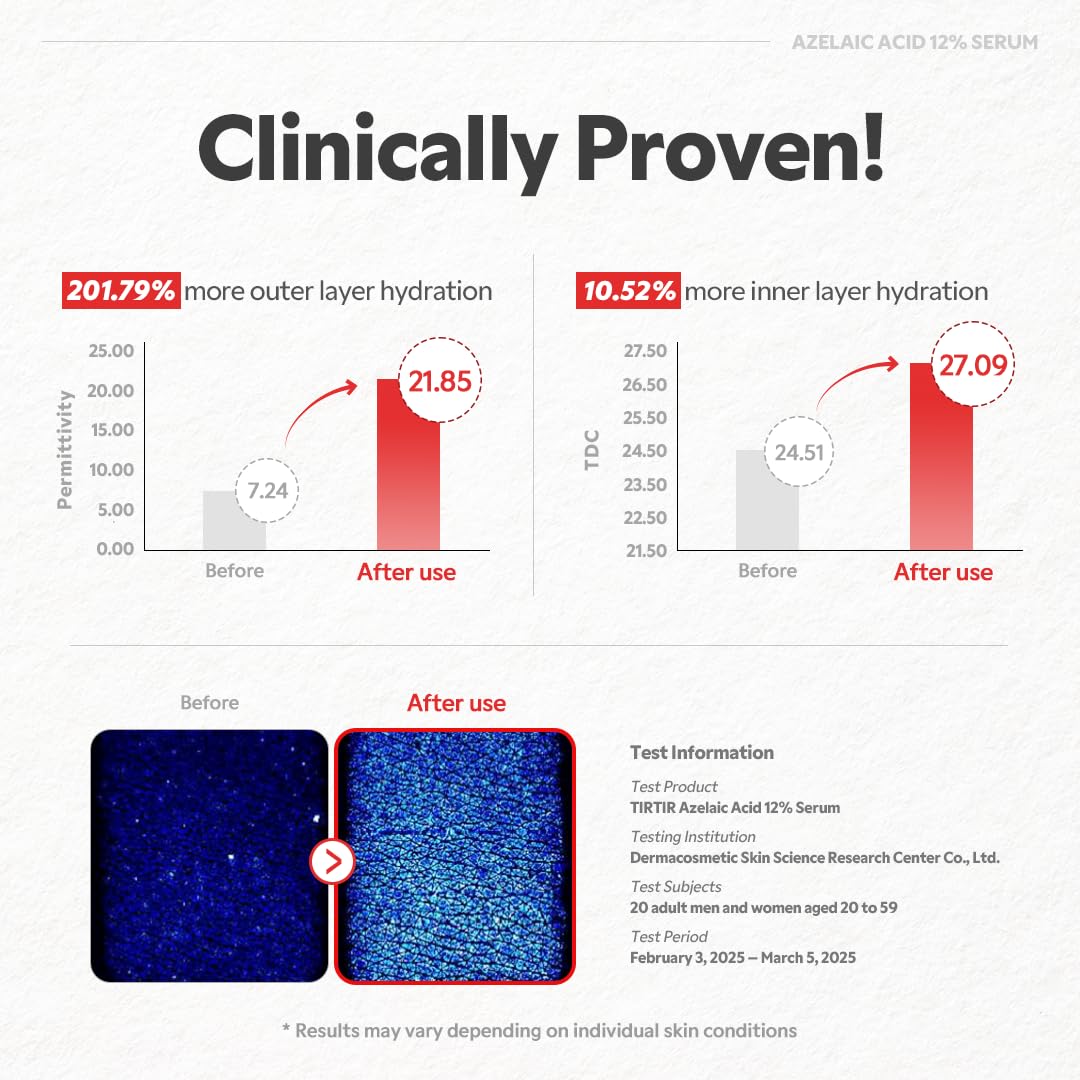 TIRTIR Azelaic Acid 12% Serum for Blemish-Prone Skin - Lightweight Hydrating Formula with Zinc PCA & Hyal-ZIP, Non-Comedogenic, Fragrance-Free, 30ml / 1.01 Fl Oz