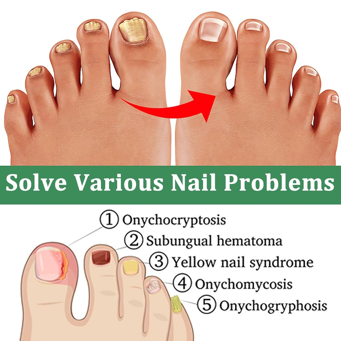 Nutraboost Nail Treatment Gel, Nail Growth Serum for Repair & Strengthener, Multi-Purpose Nail Repair Serum (2)