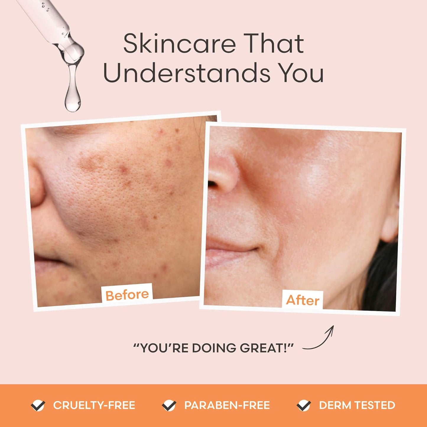 Vitamin C Serum for Face by Outofshell Beauty – 4-in-1 with Real Retinol, Hyaluronic Acid, Niacinamide – Brightening, Evens Skin Tone, Lightweight, No Irritation