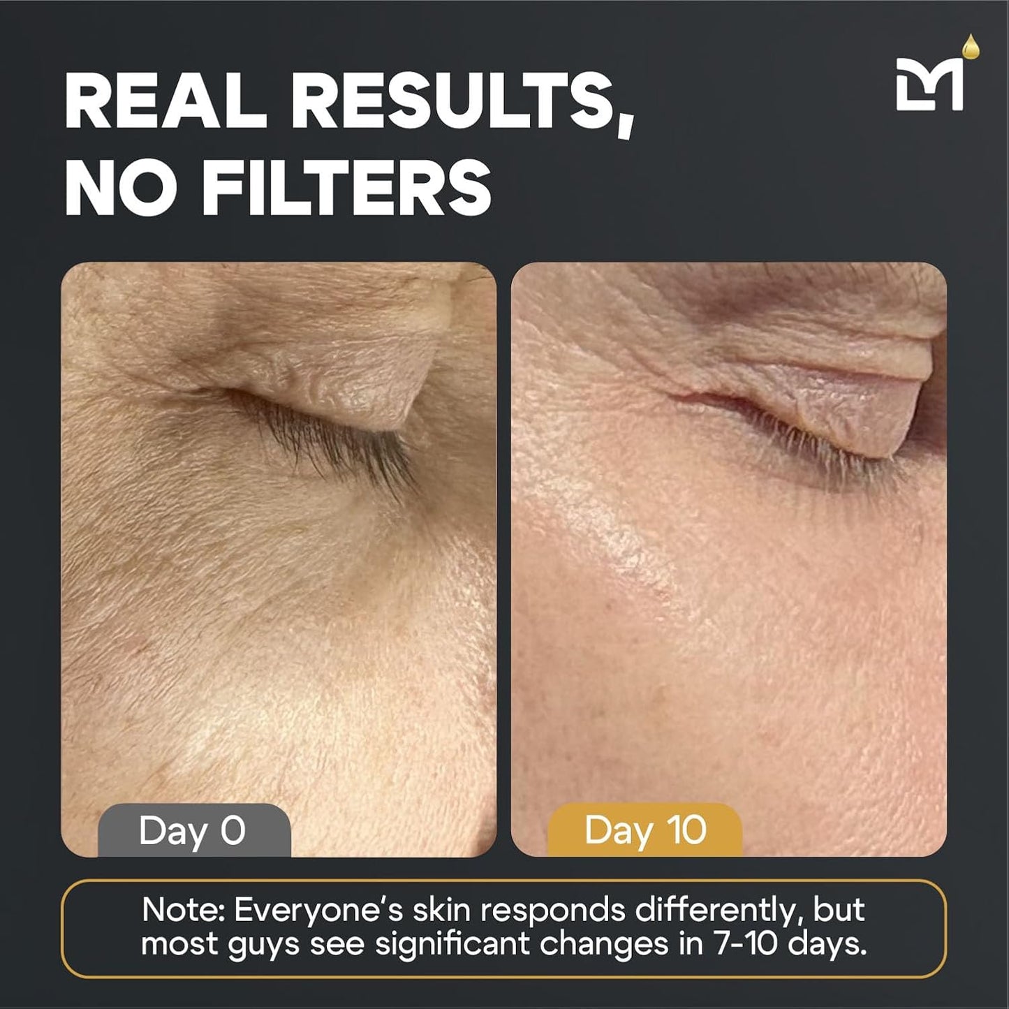 Titan Oscar Anti-Aging Mens Skin Care Kit – Wash, Face Serum, Eye Cream, Mens Face Moisturizer – Men, Skin Care Set – Dark Circles, Wrinkles, Fine Lines – Vitamin C, Peptides, Niacinamide, HA