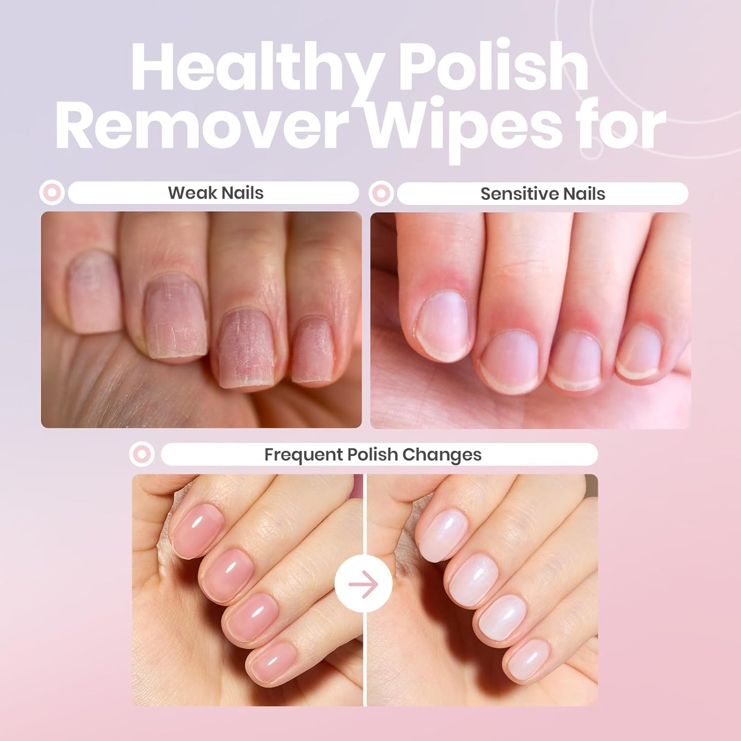 Beetles Non Acetone Nail Polish Remover - 0.67Fl Oz/20ML Controllable Nourishing Formula Acetone Free Nail Polish Remover - Non-Drying - Professional Quick and Gentle Removal for Natural Damaged Nail