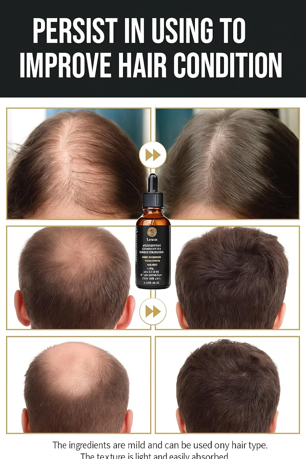 Luxeir Rosemary Mint Hair Growth Oil-Biotin Infused Scalp & Hair strengthening Oil for Thicker,Longer,Healither Hair, Treatment for Thinning Hair-Ideal for Women & Men-2 fl.Oz