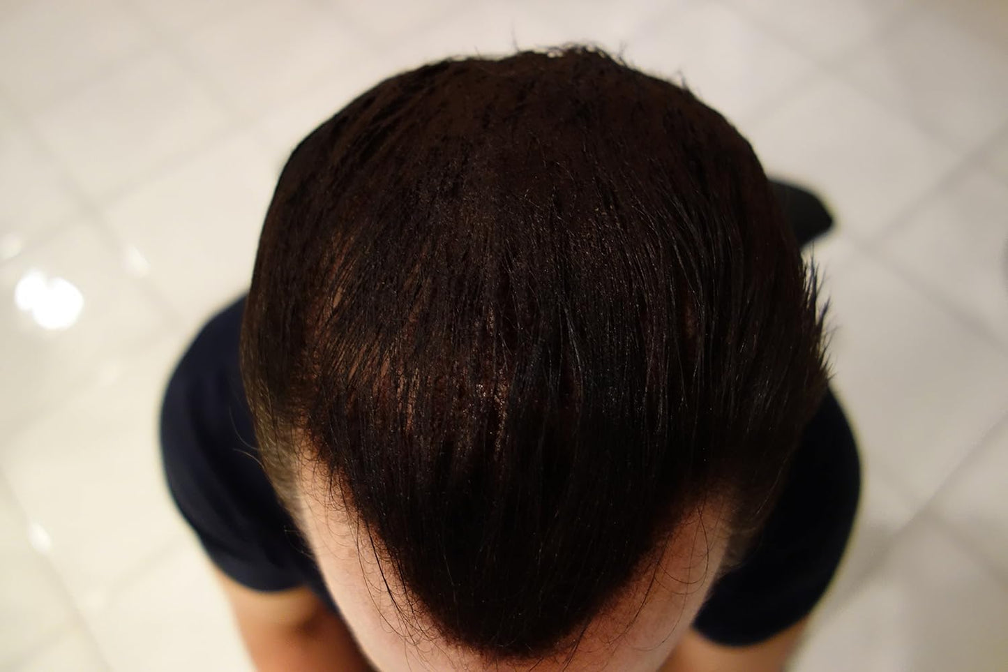 Hair Building Fibers by Finally Hair - Dark Blond 28g Bottle of Fibers and Finally Hair 120ml 4.1 oz. Bottle of Fiber Lock Hair Spray - Hair Loss Concealer Thicken Hair (Dark Blonde)