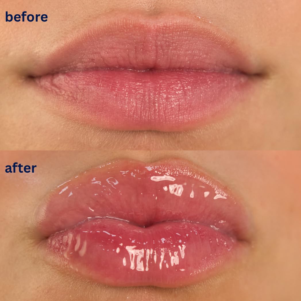 Endless Skin - Daydream - Natural Vanilla Flavor Lip Balm with Jojoba Oil, Hyaluronic Acid and Squalane - Ultra Glossy Finish that Nourishes and Hydrates Your Lips - Vegan and Paraben Free - 15ml