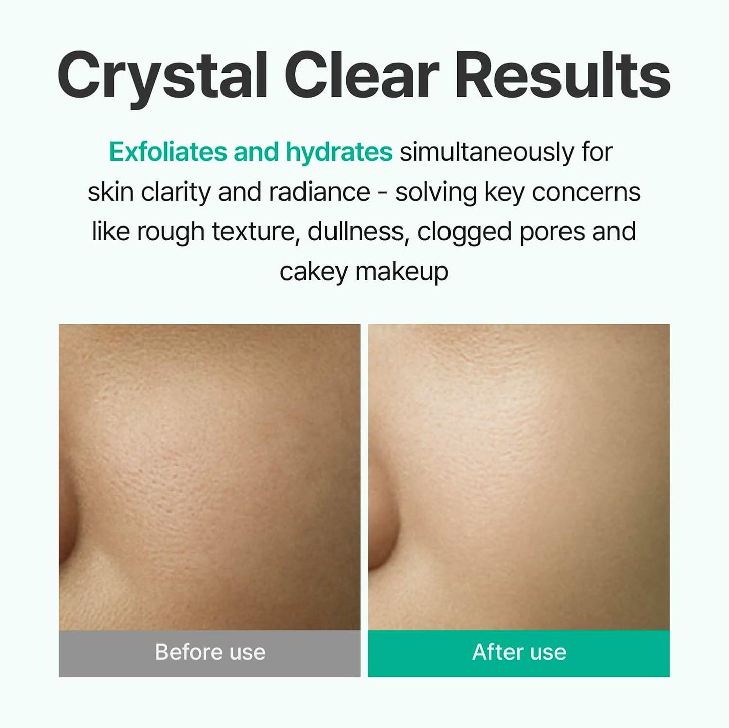 Centellian 24 AHA Aqua Peeling Boosting Ampoule (AHA Peeling Ampoule, 1.01fl oz) - Gentle Exfoliating & Hydrating Serum with AHA Complex, Refines Pores & Enhances Skin Clarity, Korean Skin Care