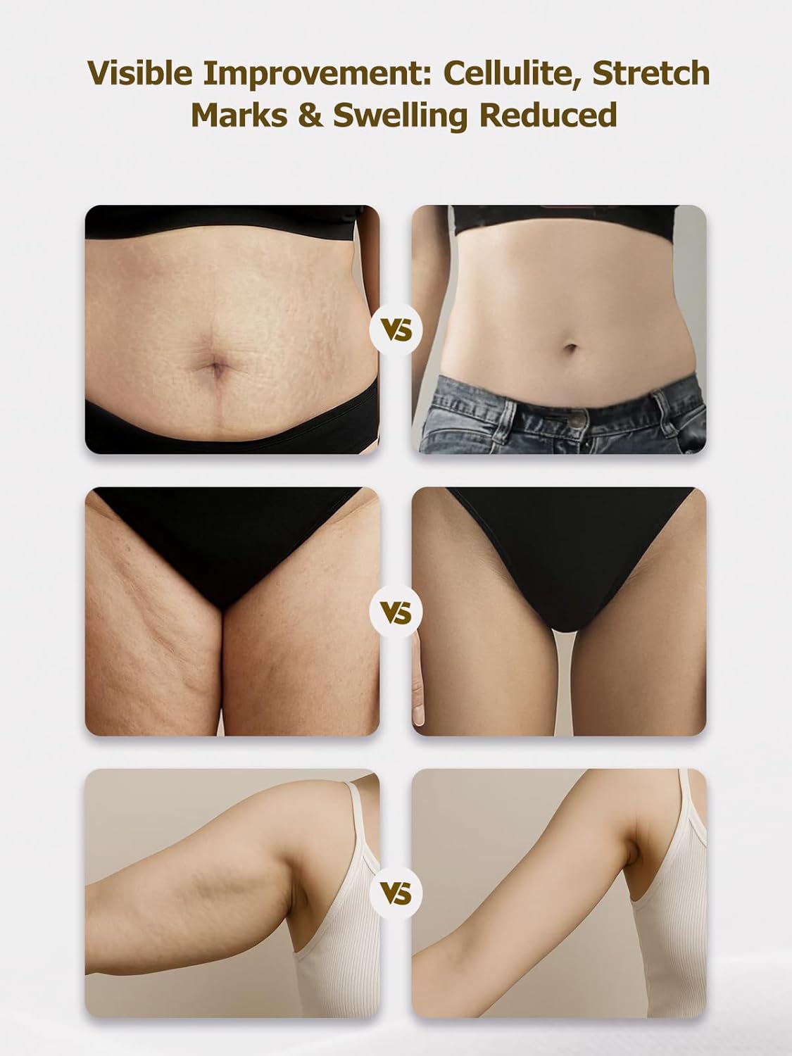 Lymphatic Drainage Massager & Anti Cellulite Massage Tool, Helps Reduce Stretch Marks & Cellulite, for Legs, Arms & Belly, Body Sculpting Machine with Microcurrent, Light, Heat & Vibration