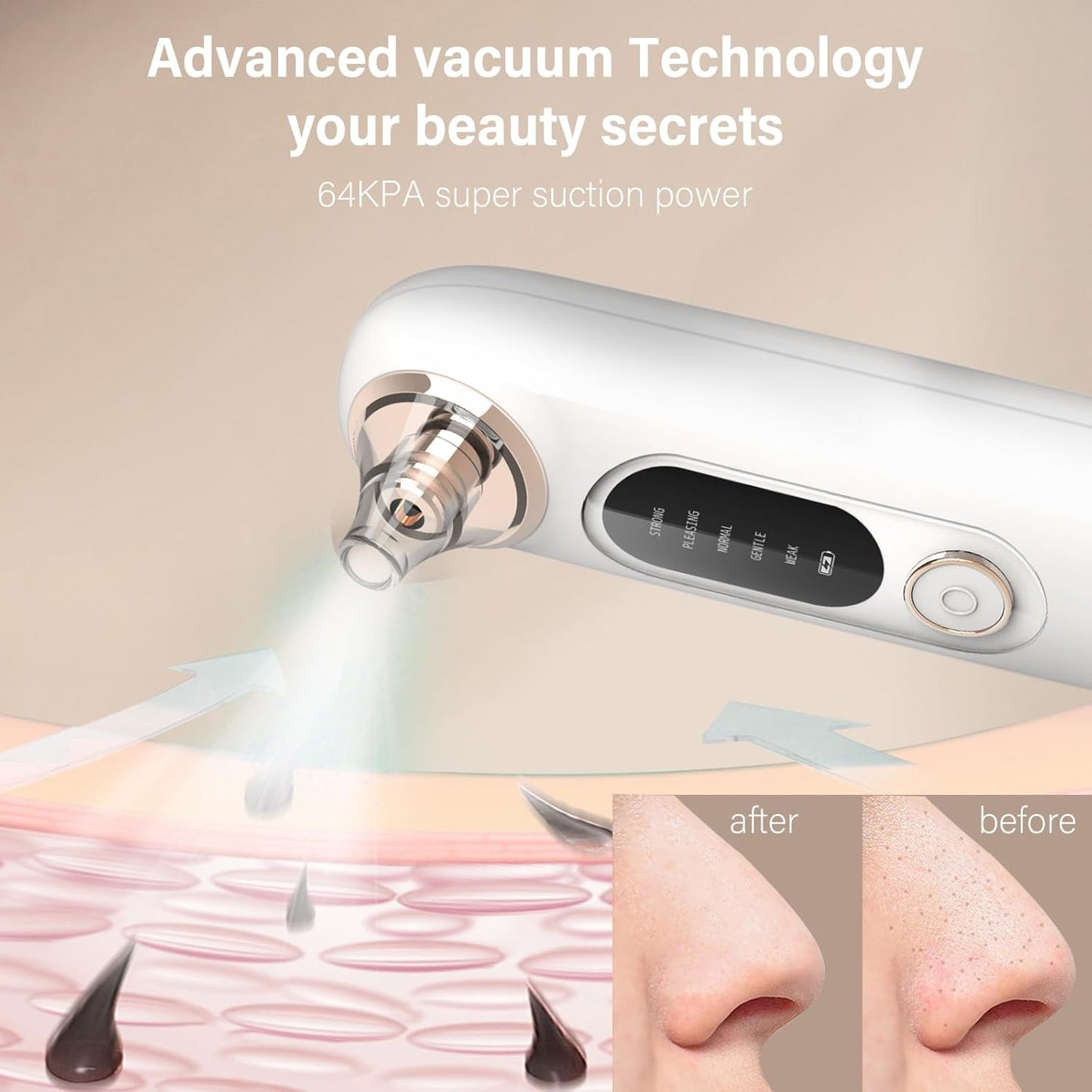 Blackhead Remover Pore Vacuum Kit for Face, 5 Adjustable Suction Levels Blackhead Extraction Tool, Face Suction Pore Cleaner with 4 Suction Heads, 4 Probes for Women & Men (White)