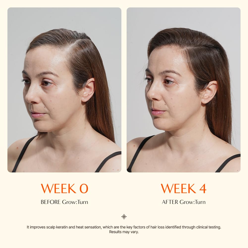 Growturn Hair Growth Serum with Built in Brush for Hair Growth & Thickening | Treatment for Thinning Hair, Hair Loss | Low Irritation, Fragrance-Free, Sulfate & Paraben-Free, 3.38 fl. oz. (Pack of 1)