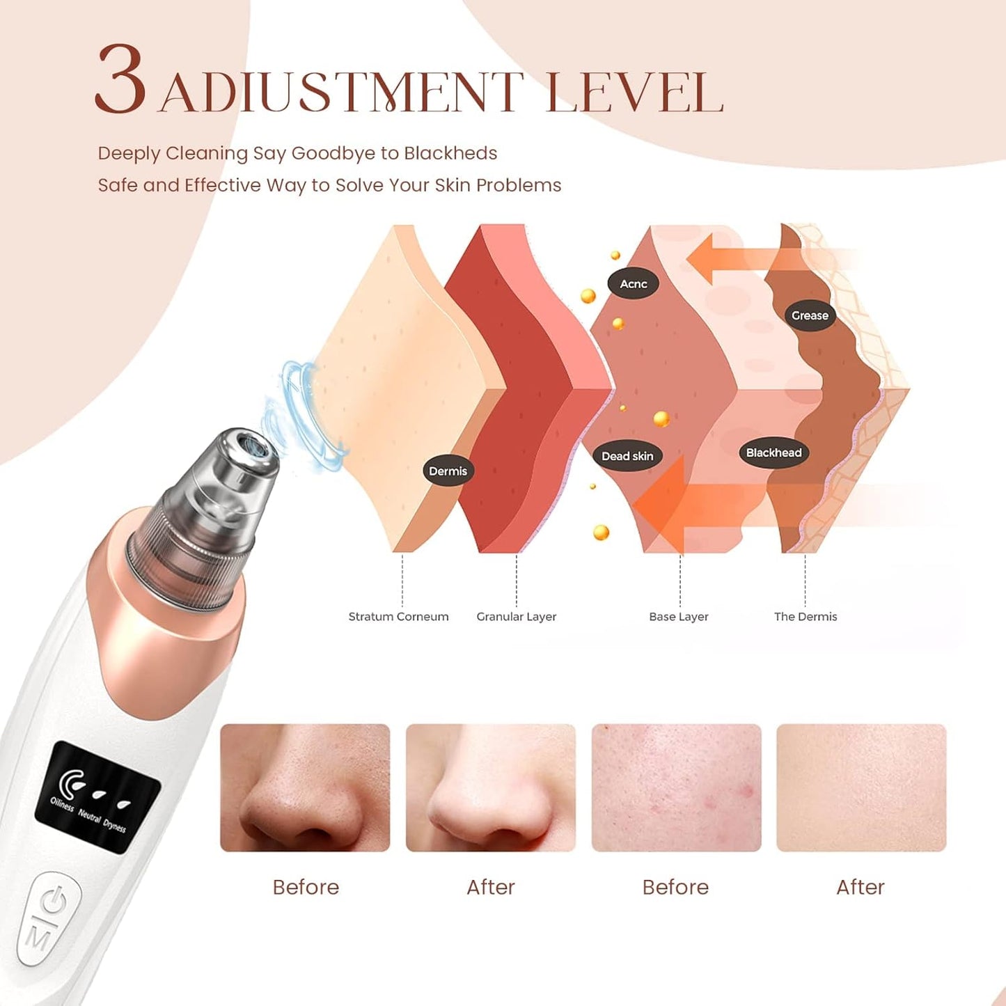 2025 Blackhead Remover Pore Vacuum,Facial Pore Cleaner-5 Suction Power,5 Probes,USB Rechargeable Blackhead Vacuum Kit Electric Acne Extractor Tool for Adult