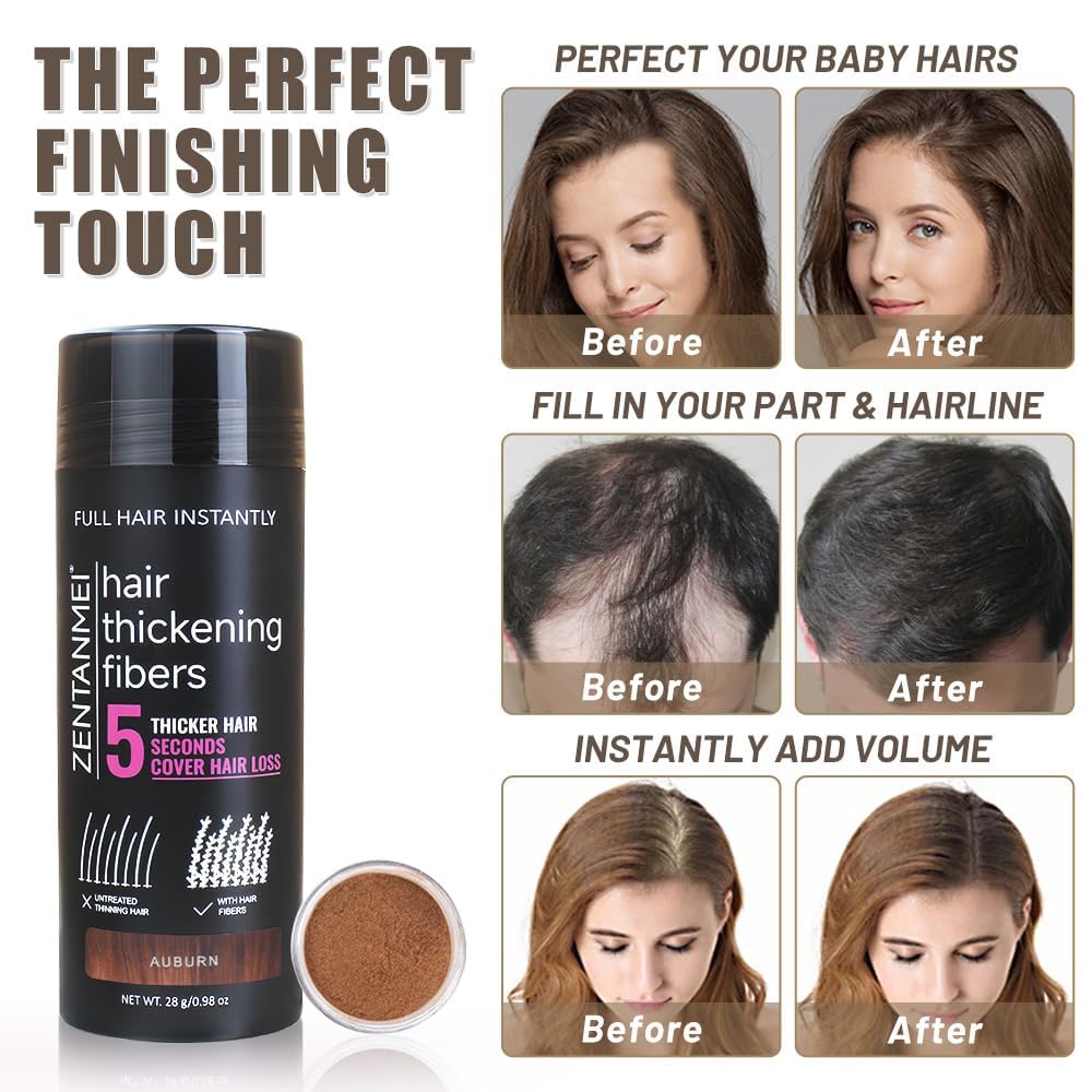 Hair Fibers for Thinning Hair for Women All-Natural Hair Building Fibers 0.98 Oz Hair Volume Powder Bald Spot Cover Up for Men & Women (Dark Brown)