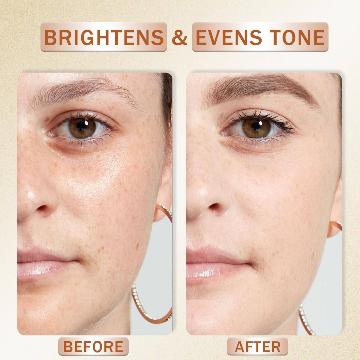 Vitamin C Serum for Face with Hyaluronic Acid, Boost Skin Collagen, Brightening, Antioxidant, Anti-Aging, Hydrate & Plump, Improve Appearance of Dark Spots, Tone, Fine Lines Facial Serum 30ml/1 fl oz