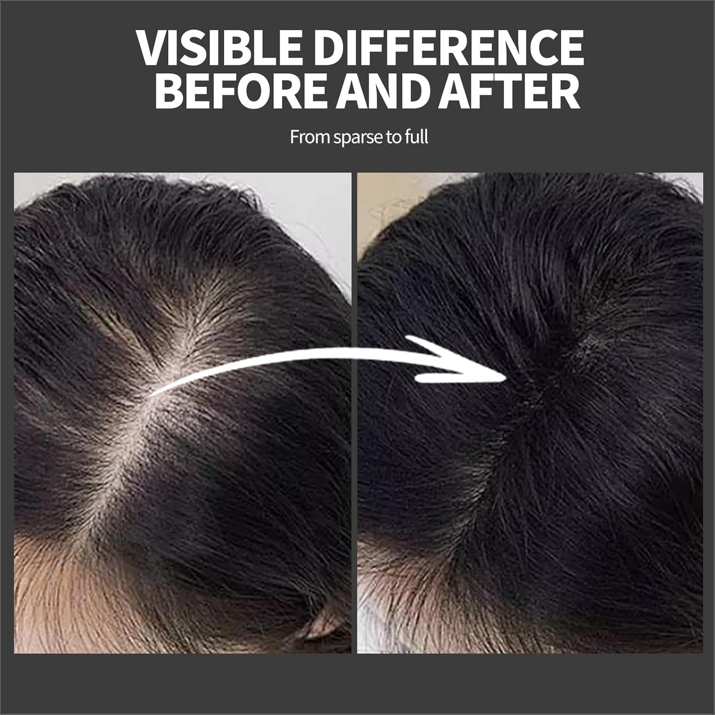 Hair Building Fibers - Instant Volume for Thinning Hair, Natural Appearance with Electrostatic Adsorption,Plant-Based, All-Day Hold, 25G Light brown