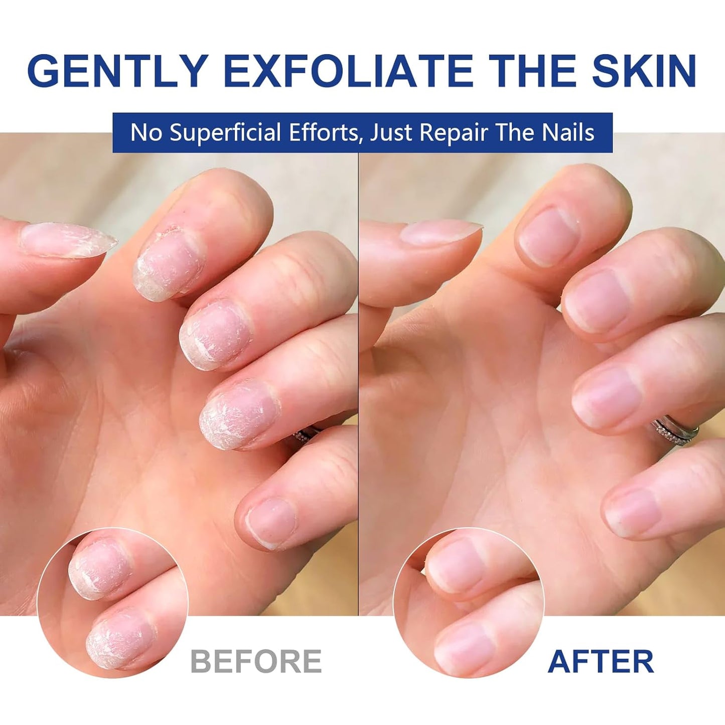 Nails Spray, New Tea Oil Extra-Strength Toenail Treatment, 7 Days Nail Treatment | Keeps Feet Fresh & Dry All Day | Men & Women (1 PCS)