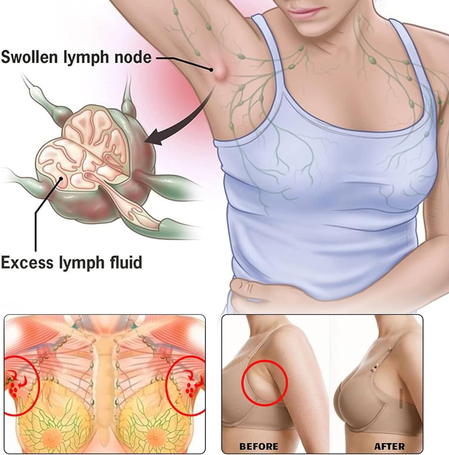 24Pcs/Box Herbal Lymph Nodes Patch,Lymphatic Drainage Patch/Patches,Herbal Lymphatic Drainage Care Patch,Neck Lymph Nodes Patch, Lymphatic Massage for Men and Women