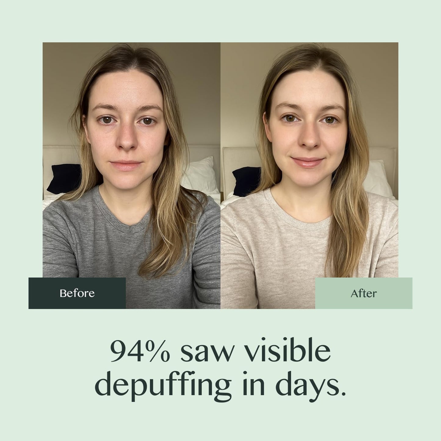 Caffeine Eye Cream for Dark Circles and Puffiness – Moonstone Under Eye Cream with Cooling Tip, Retinol, Hyaluronic Acid & Peptides – for Wrinkles, Bags, Fine Lines – Fragrance-Free