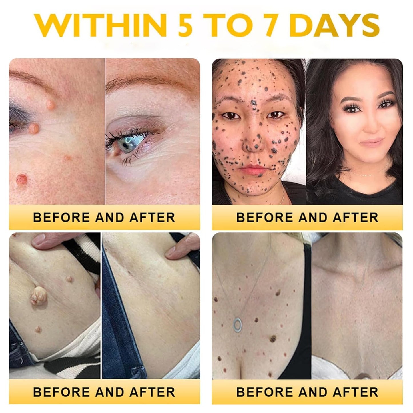 Bee Venom Skin Restoration Cream,Natural Bee Venom Comprehensive Cream,Effectively Firms skin and Reduces Imperfections Anti-Wrinkle Moisturizing for All skin Typess (2PCS)