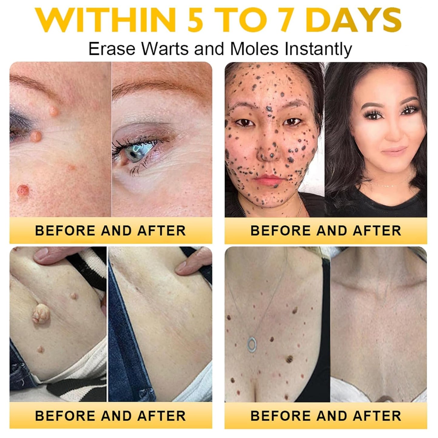 Bee Venom Skin Restoration Cream, Bee Venom Skin Treatment Cream, Professional Bee Venom Comprehensive cream - Anti-Wrinkle Moisturizing for All skin Typess (2)