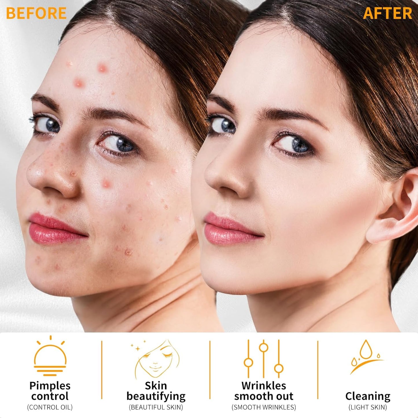 MYSWEETY High F Rrequncy Portable Handheld Facial Skin Care Wand Machine