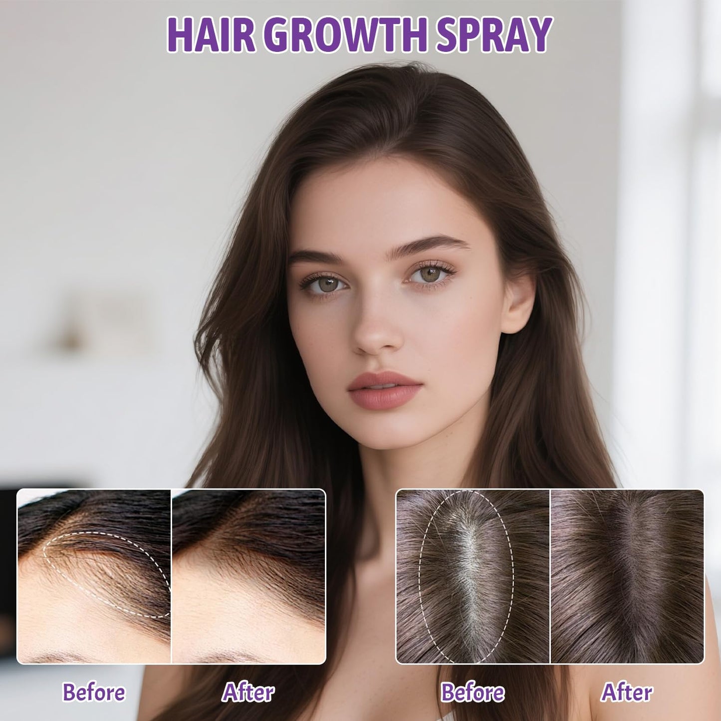 3.38 fl.oz - 5% Minoxidil for Women Hair Growth, Minoxidil Spray with Biotin for Thicker, Stronger, Fuller & Healthier Hair, Hair Regrowth Treatment for Reduce Hair Loss & Thinning, for All Hair Types