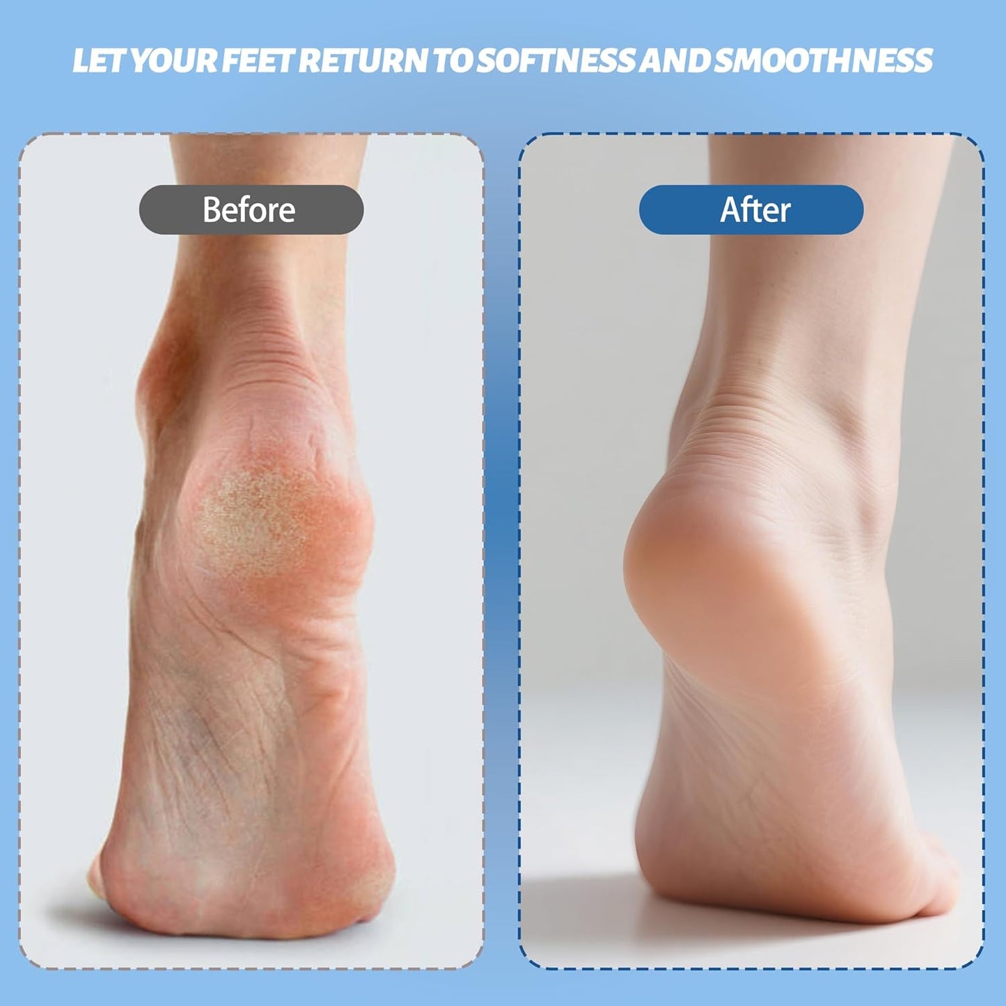 Electric Feet Foot Callus Remover Equipped with A Vacuum System Foot Scrubber 17 in 1 Professional Foot Care Tool Ipx6 Waterproof Rating for Removing Hard Cracks Dryness and Dead Skin (White)