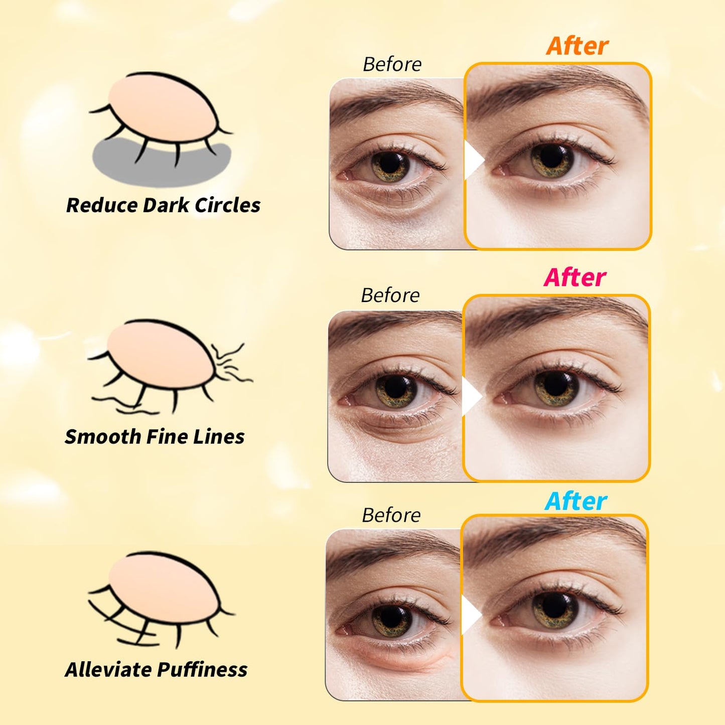 Under Eye Patches(48 Pairs), 24K Gold, Caffeine, Retinol Eye Masks for Puffy Eyes, Wrinkles, Dark Circles, Undereye Bags Treatment - Restoring & Awakening & Moisturizer Skin care Gift for Women