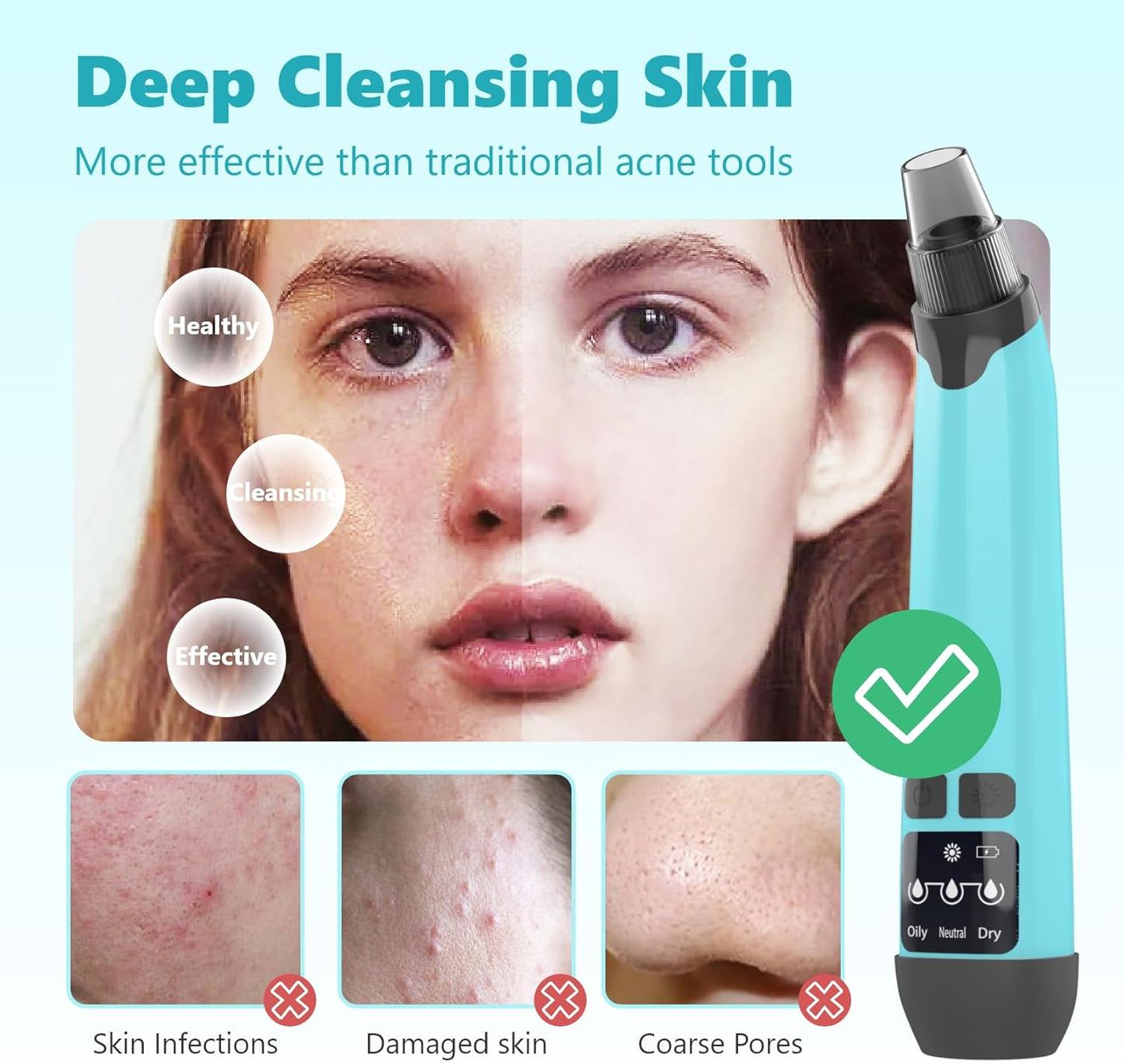 Blackhead Remover Vacuum - Black Head Remover for Face,Blackhead Extractor Tool with 3 Adjustable Suction Levels,4 Probes,USB Interface Type Pore Vacuum,Suitable for Women and Men (Green)