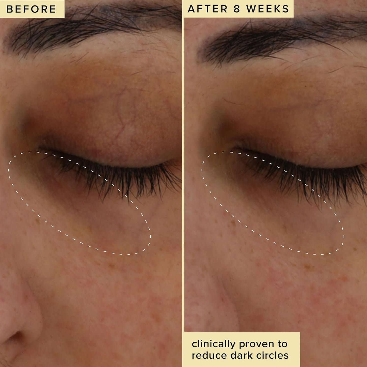 Farmacy Wake Up Honey Vitamin C Eye Cream - Brightening Under Eye Cream for Dark Circles + Puffiness - Enriched with Cranberry Peptide to Smooth Wrinkles Over Time (15ml)