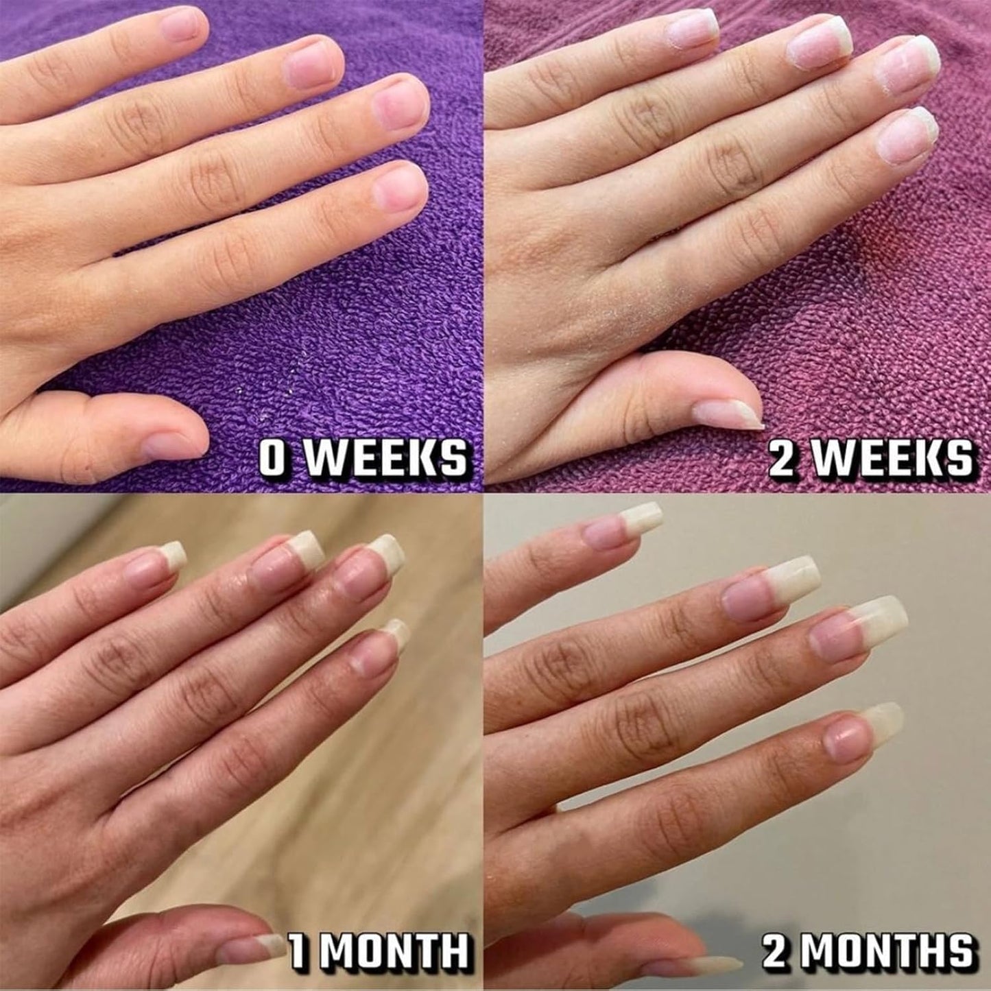 Nailz Nail 𝐆𝐫𝐨𝐰𝐭𝐡 Pen, Radiant Cuticle Oil Pen, Serum Cuticle Oil for Nails, Nail 𝐍𝐮𝐭𝐫𝐢𝐞𝐧𝐭 Oil Pens for Moisturize Strengthen 𝐁𝐫𝐢𝐠𝐡𝐭𝐞𝐧 Nails Care (4pcs, 2ml)