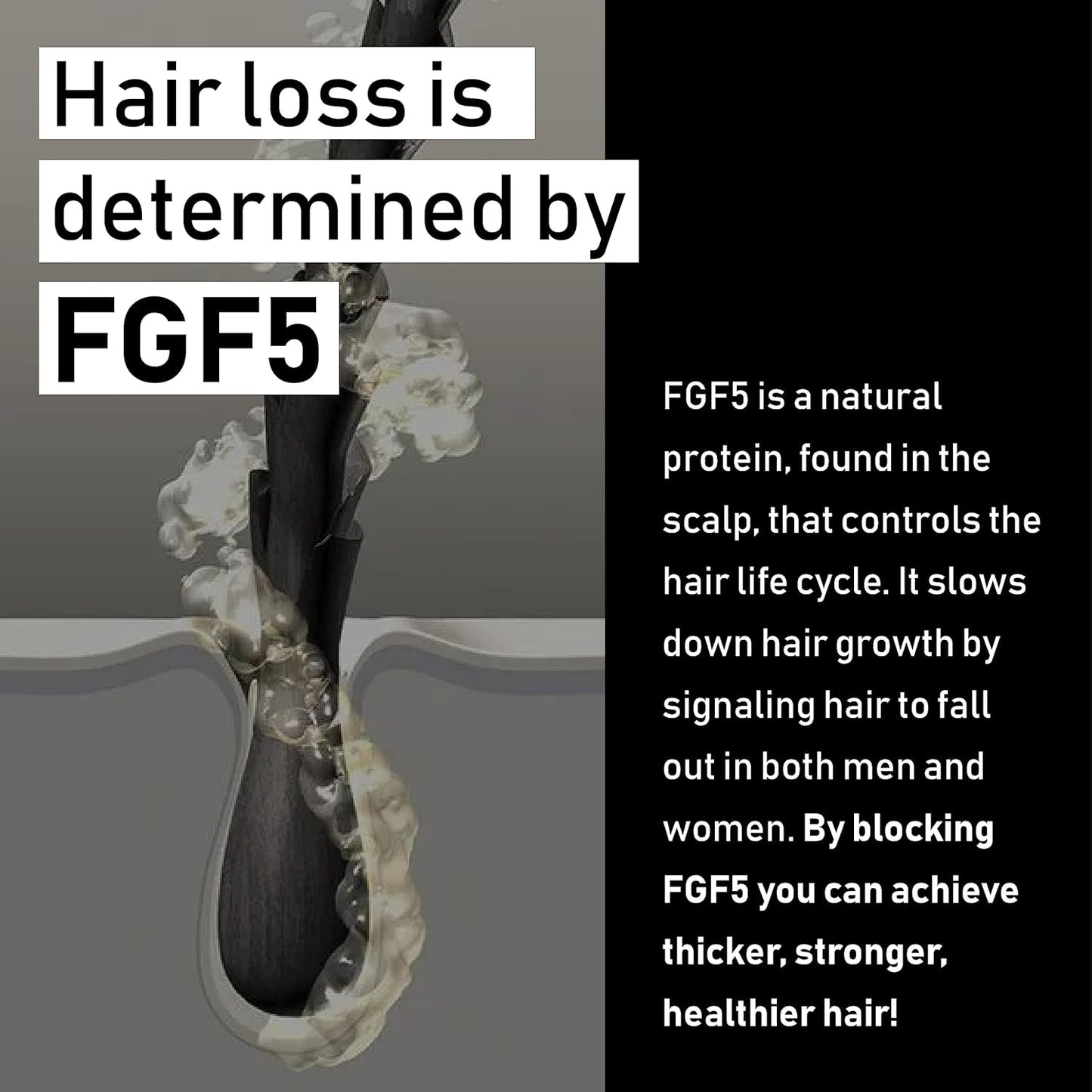 EVOLIS Reverse Scalp Activator - Hair Growth Serum - Scalp Serum & Hair Thickening Scalp Treatment for Fuller, Thicker Hair (1.7 fl oz)