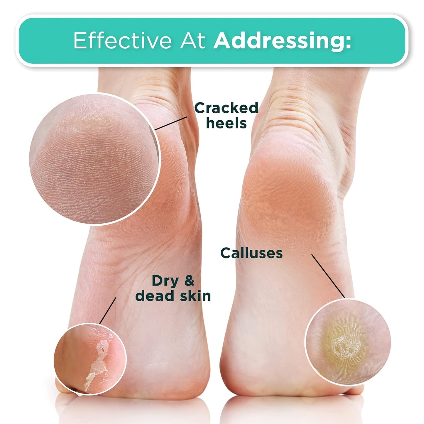 DERMORA Foot Peel Mask | Skin Exfoliating Foot Masks | Dry, Cracked Feet, Callus, Dead Skin Remover | Baby Soft Feet, Tea Tree Scent | Pack of 2 | Regular