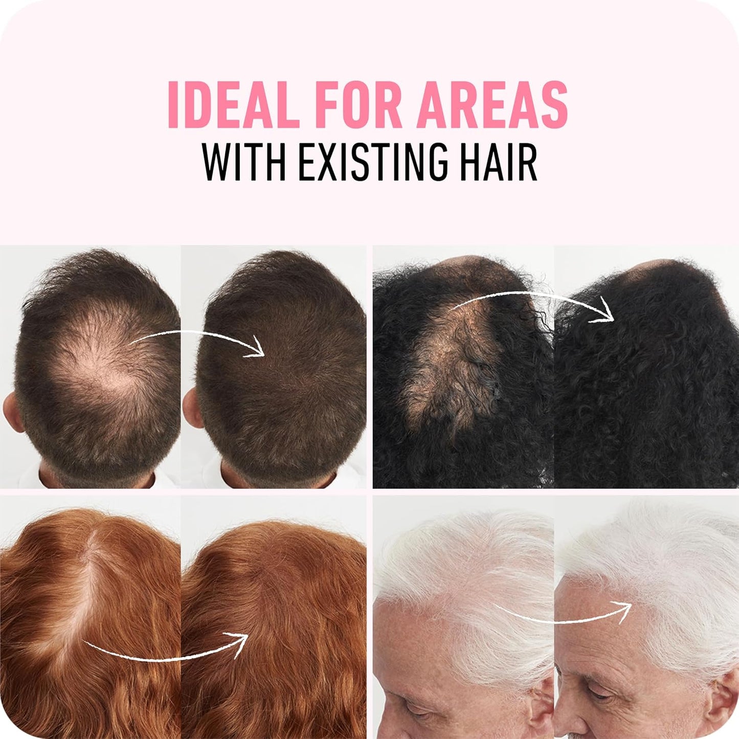 BOLDIFY Hair Fibers (28g) - Fill In Thinning and Fine Hair for an Instantly Fuller, Thicker Look - 14 Shades for Women & Men - Medium Brown