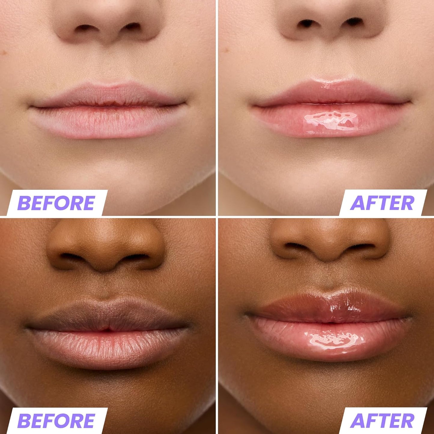 Wonderskin Lip Oil Rehab Serum - Tinted Lip Oil, Hydrating, Moisturizing, and Non-Sticky Coral Pink Tint Serum for Dry Lips (Lover)