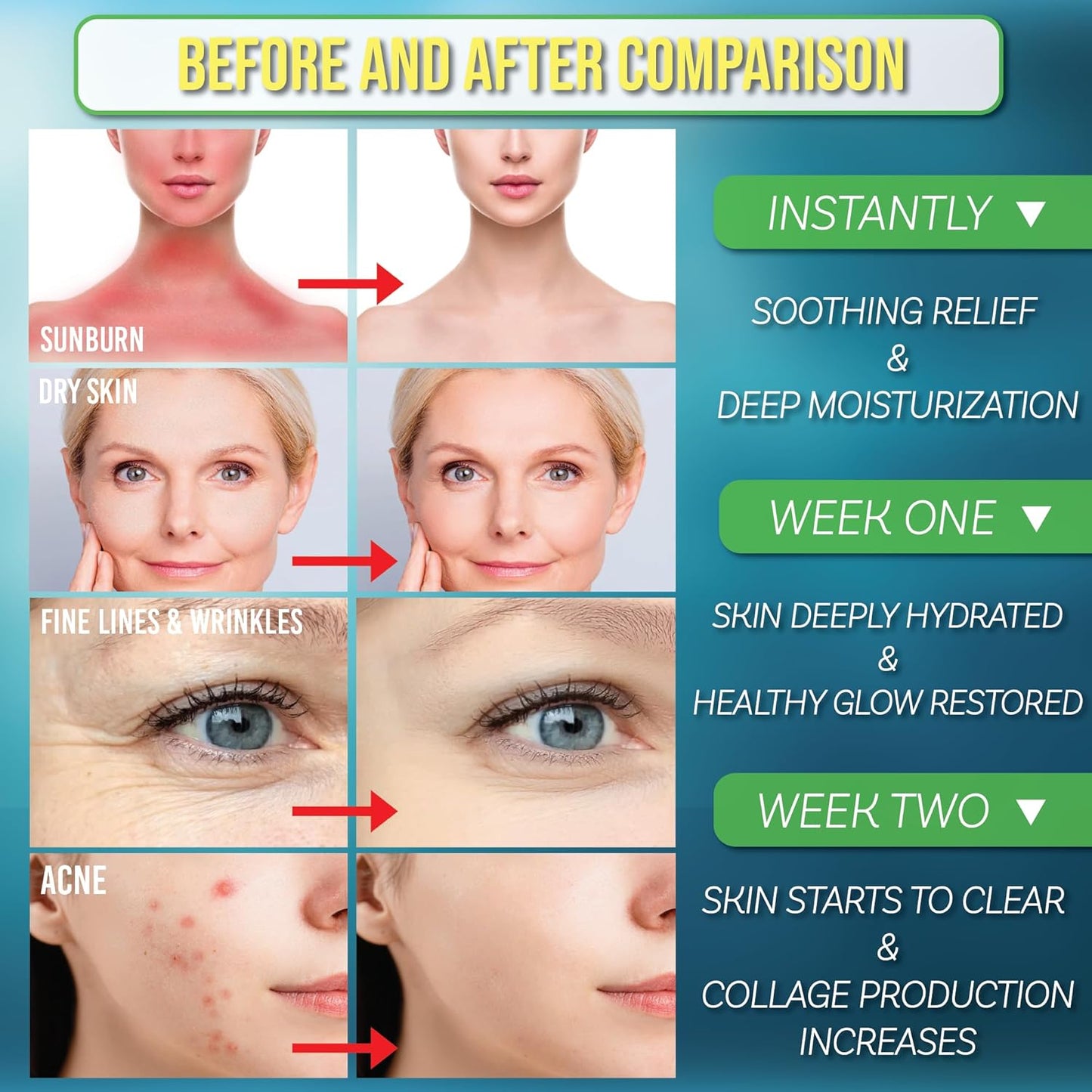 Green Leaf Naturals Aloe Vera Spray | 99% Cold-Pressed Aloe Vera Juice with Vitamin C, E & A | Hair, Skin, Facial Moisturizer, Sunburn Relief & After Sun Lotion 12oz