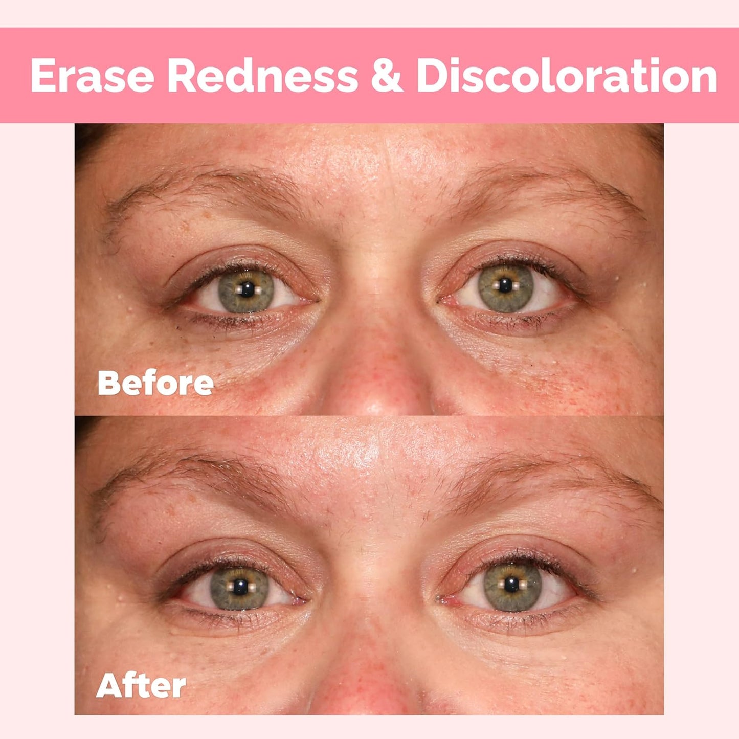 Elizabeth Mott Thank Me Later Under Eye Brightener & Primer – Hydrating Color Corrector for Dark Circles – Lightweight Concealer Base for Mature Skin, Medium Shade 5ml