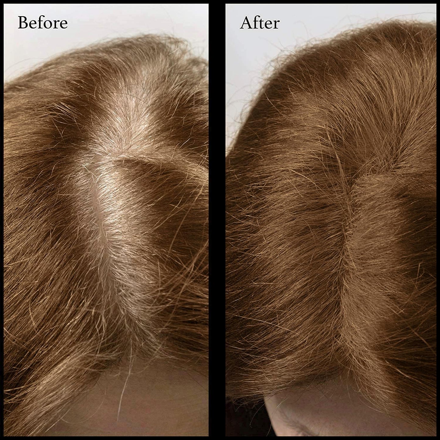 Root Touch Up Powder - Natural Hairline Concealer with 11 Shades - Free of Fragrance, Talc & Parabens (With Brush, Warm Brown)